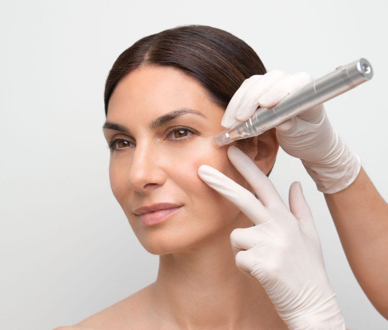 Microneedling met de Dermapen